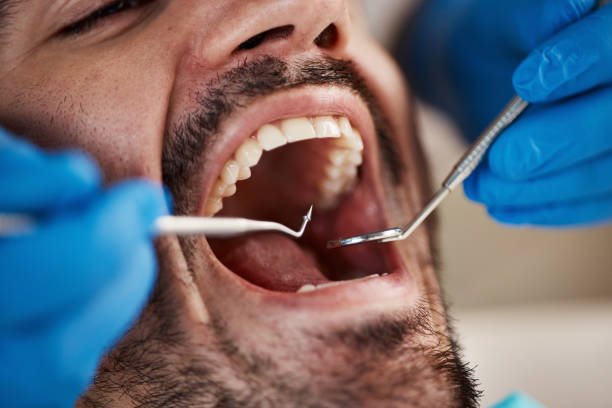 Best Same-Day Emergency Dental Services in Garrison, ND